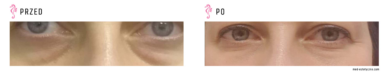 Gabinet dr Joanny Janeckiej najniższe ceny medycyna estetyczna woj. śląskie