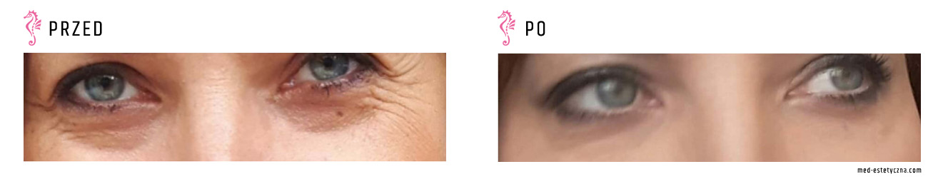 Gabinet dr Joanny Janeckiej najniższe ceny medycyna estetyczna woj. śląskie