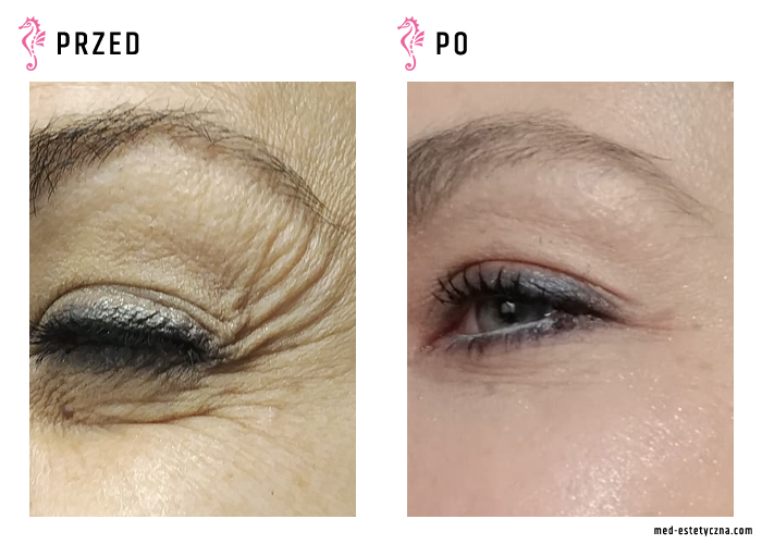 Gabinet dr Joanny Janeckiej najniższe ceny medycyna estetyczna woj. śląskie