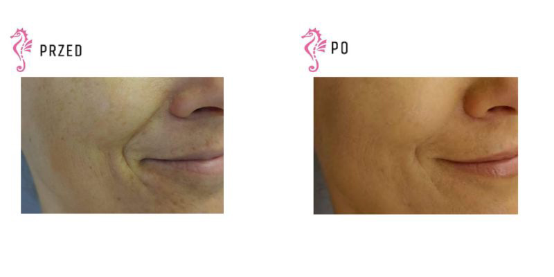 Gabinet dr Joanny Janeckiej najniższe ceny medycyna estetyczna woj. śląskie