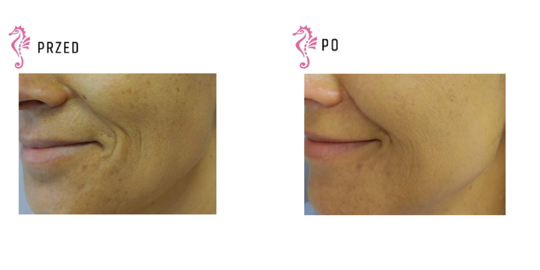 Gabinet dr Joanny Janeckiej najniższe ceny medycyna estetyczna woj. śląskie