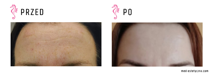 Gabinet dr Joanny Janeckiej najniższe ceny medycyna estetyczna woj. śląskie