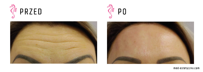 Gabinet dr Joanny Janeckiej najniższe ceny medycyna estetyczna woj. śląskie