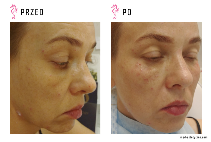 Gabinet dr Joanny Janeckiej najniższe ceny medycyna estetyczna woj. śląskie