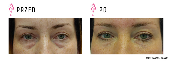 Gabinet dr Joanny Janeckiej najniższe ceny medycyna estetyczna woj. śląskie