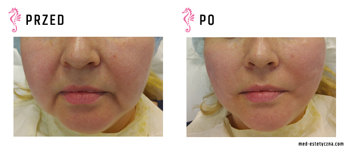 Gabinet dr Joanny Janeckiej najniższe ceny medycyna estetyczna woj. śląskie