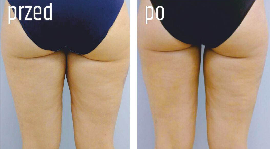 Gabinet dr Joanny Janeckiej najniższe ceny medycyna estetyczna woj. śląskie