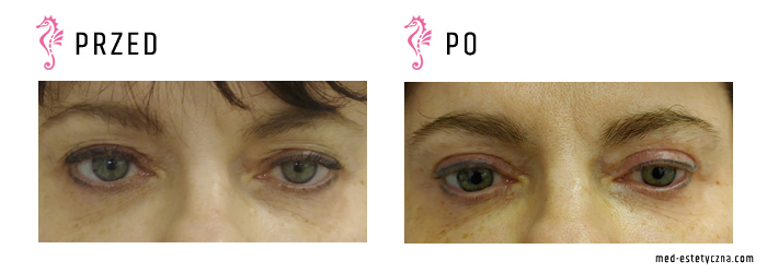 Gabinet dr Joanny Janeckiej najniższe ceny medycyna estetyczna woj. śląskie