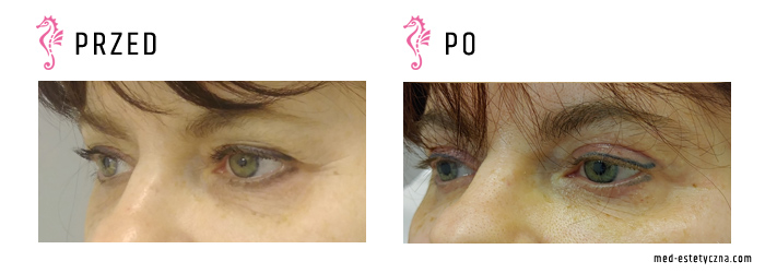 Gabinet dr Joanny Janeckiej najniższe ceny medycyna estetyczna woj. śląskie