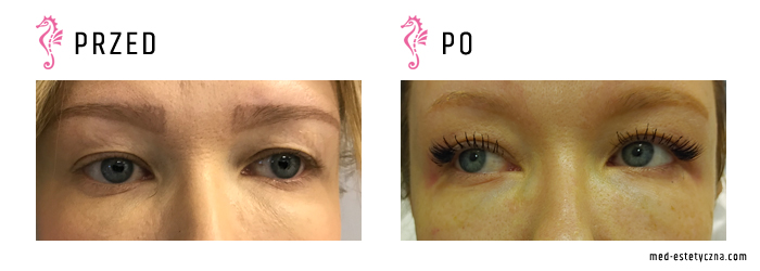 Gabinet dr Joanny Janeckiej najniższe ceny medycyna estetyczna woj. śląskie