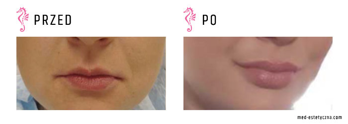 Gabinet dr Joanny Janeckiej najniższe ceny medycyna estetyczna woj. śląskie