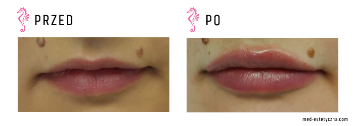 Gabinet dr Joanny Janeckiej najniższe ceny medycyna estetyczna woj. śląskie