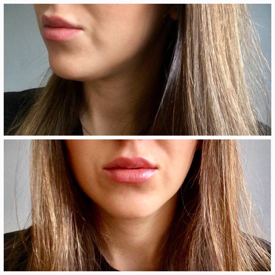 Gabinet dr Joanny Janeckiej najniższe ceny medycyna estetyczna woj. śląskie